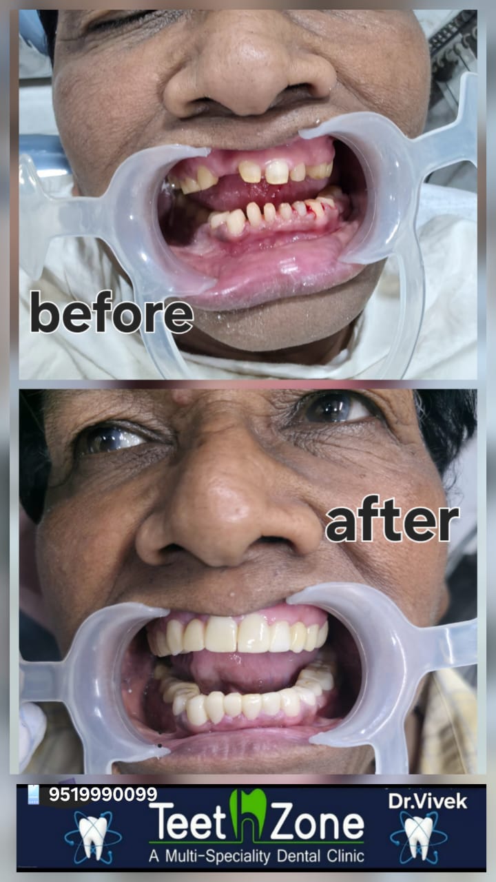 Before and after dental makeover results