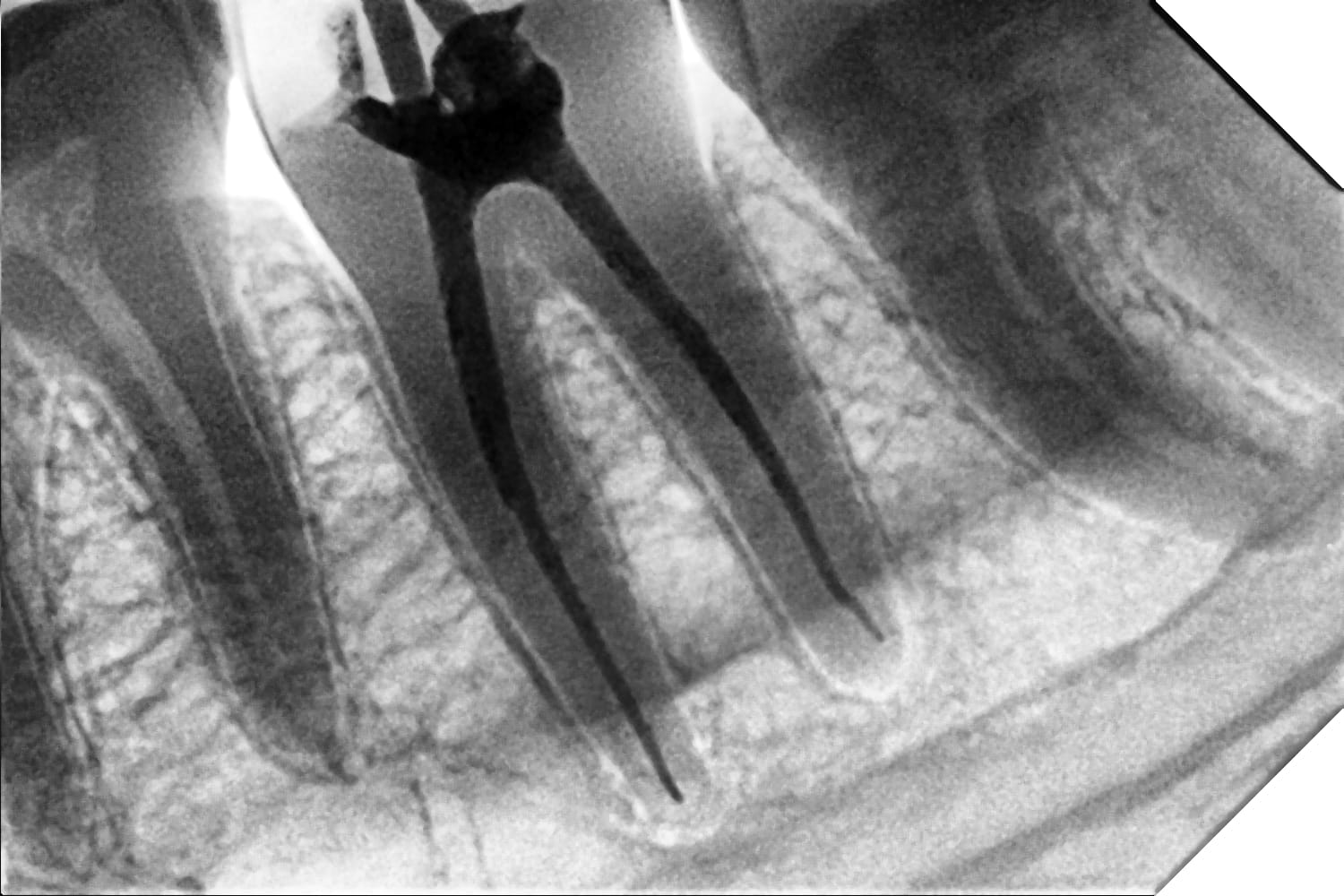 Digital dental X-ray machine at TeethZone Lucknow