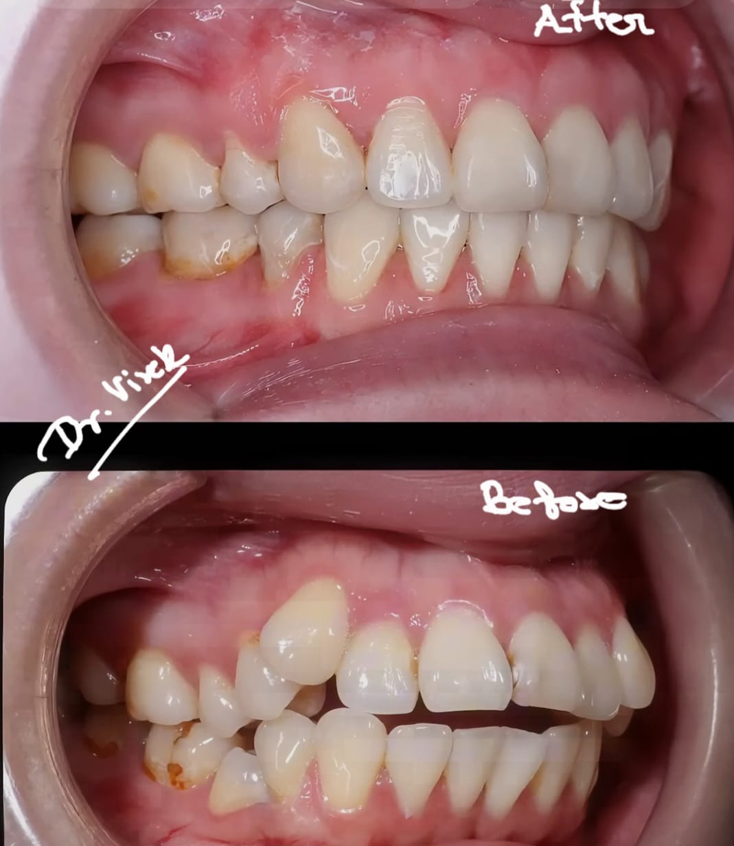 Oral cancer screening procedure